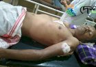 One Injured in Leopard Attack at Lakhowjan Tea Estate, Bokakhat.