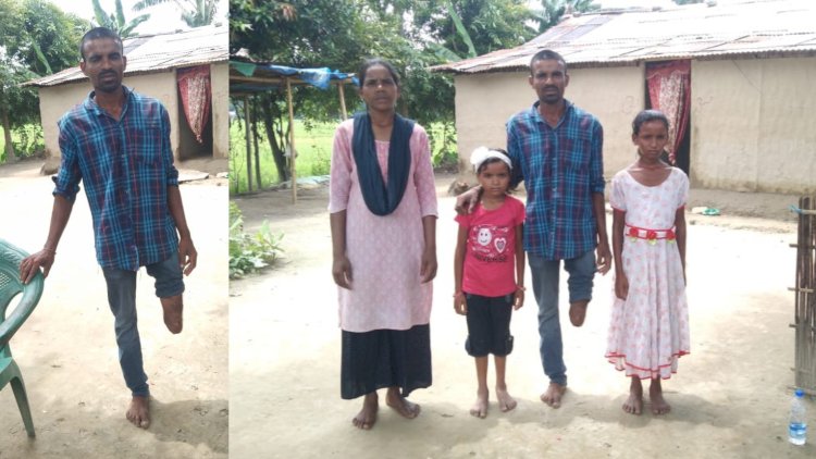 সামাজিক মাধ্যমৰ প্ৰচাৰেই পৰিবৰ্তন আনিলে বোকাখাতৰ বিকি বৰাইকৰ জীৱনলৈ : বোকাখাতৰ সাংবাদিকৰ উদ্যোগত কৃত্ৰিম অংগ সংস্থাপনেৰে এতিয়া লাভ কৰিব নতুন জীৱন :